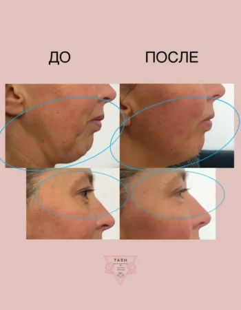 Массаж в Монпелье