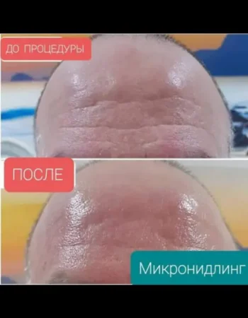 Косметолог-эстетист Татьяна