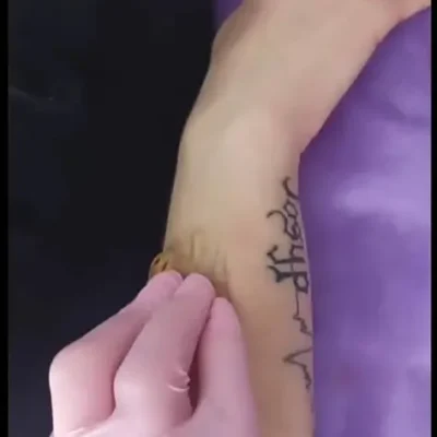 Шугаринг любой части тела