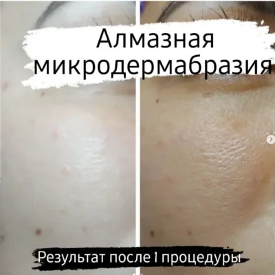 Косметолог в марселе Юлия